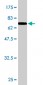ADRM1 Antibody (monoclonal) (M02)
